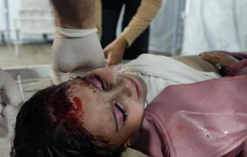 إصابة 3 طفلات برصاص الاحتلال في حي الشجاعية