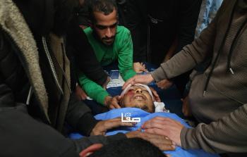 الصحة: شهيد و5 إصابات وصلوا مستشفيات غزة خلال 24 ساعة