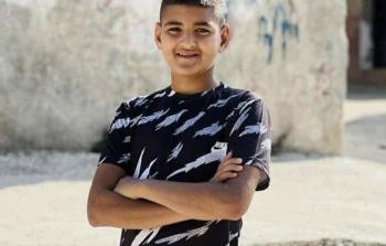 الصحة: إصابة حرجة برصاص الاحتلال في مخيم الجلزون