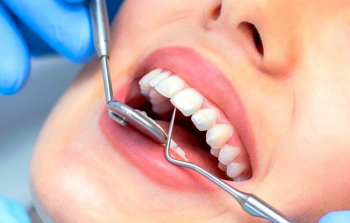جامعة الأزهر - منح طب أسنان بـ 2000 دولار من PAMA