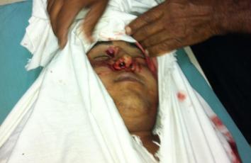 الشهيد المصري