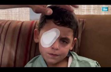 محمد حجازي.. طفل من غزة أطفأت قنابل الاحتلال نور عينيه