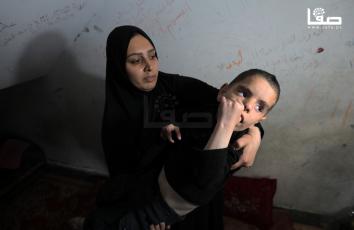طفل نازح يعاني شلل دماغي وسط نقص حاد في الأدوية والغذاء بغزة