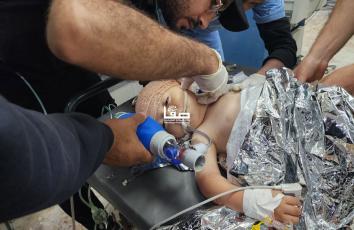 إصابات معظمهم من الأطفال جراء قصف على مخيم خانيونس