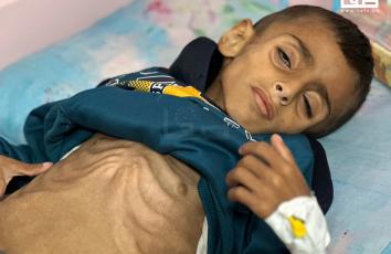 الطفل أسامة الرقب يعاني من أوضاع صحية وسوء تغذية نتيجة عدم توفر العلاج له في غزة