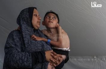 الطفل محمد أبو ناجي (10 أعوام) مصاب بالشلل الدماغي في غزة