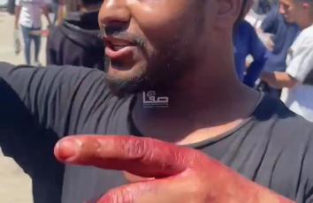 "كلهم يا نتنياهو أطفال".. مواطن يروي لـ"صفا" تفاصيل المجزرة المروّعة قرب مفترق السرايا في مدينة