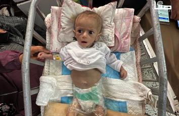 سوء التغذية ونقص العلاج يهدد حياة (سوار عاشور) من خانيونس بسبب استمرار إغلاق المعابر في غزة