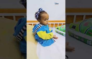 سوء التغذية يفتك بعشرات الأطفال في غزة