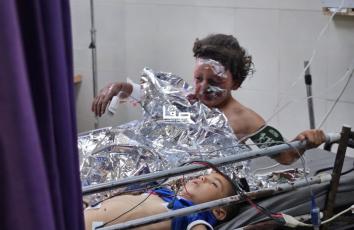 أطفال أصيبوا بحروق إثر قصف إسرائيلي استهدف في خانيونس