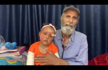 حنين الوادية (5 أعوام) ناجية وحيدة من مجزرة تعرضت لها عائلتها في مدرسة الجرجاوي بغزة