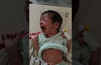 الرضيع جبر أبو قليق يبلغ من العمر أسبوعا واحدا يعاني من سوء تغذية وطفح جلدي