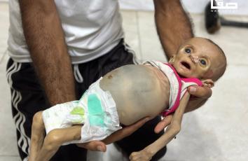 تشييع جثمان الرضيعة زينب أبو حليب التي توفيت جراء سوء التغذية في مجمع ناصر الطبي بخان يونس جنوبي قطاع غزة