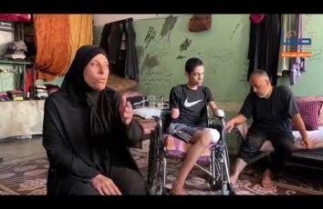 عبد الكريم أبو عمشة 15عامًا فقد ثلاثة من أطرافه بقصف إسرائيلي طال مدرسة للنازحين بغزة وحرمه من طموحه