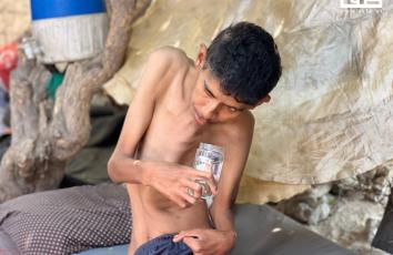 شاب من ذوي الاحتياجات الخاصة يعاني سوء التغذية في غزة