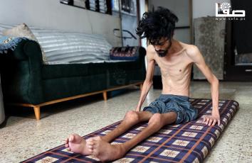 حذيفة درويش (36عامًا) يعاني صعوبة الحركة بسبب إصابته بقصف منزلهم وسوء التغذية في  غزة