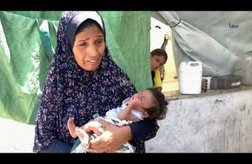 والدته تناشد توفير الحليب لإنقاذ حياته.. الرضيع عمار يعاني سوء التغذية