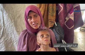 والده شهـ.ـيد.. الرضيع محمد المطوق يعاني من سوء التغذية الحاد بسبب المجاعة في غزة