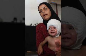 إصابة الرضيع محمد حجيلة بحروق شديدة جراء قصف إسرائيلي على غزة