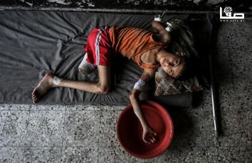 سمير زقوت (١١ عامًا) يعيش على انقاض منزلهم المدمر الذي فقد ساقه ويده في قصفه بمدينة غزة