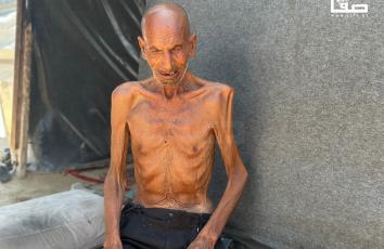 مُسن يفقد أكثر من 40 كيلو من وزنه بسبب الجوع في خان يونس جنوبي قطاع غزة