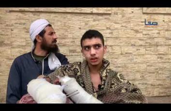 الجريح جهاد راجح بترت ساقه اليسرى ويعاني من جروح بليغة في يديه يطالب بالإسراع في سفره للخارج للعلاج