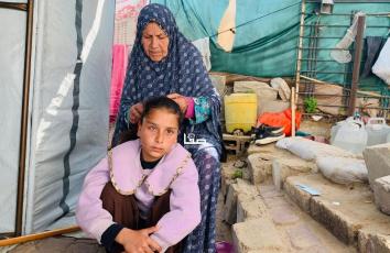 عائلة الطفلة إيلا النمنم تطالب بالسماح لها بالسفر للعلاج من إصابة في عينها اليمنى