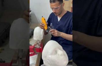 بمواد محلية.. محمد القطراوي ينتج أقنعة ضاغطة لعلاج تشوهات وندوبات جرحى الحرب في غزة