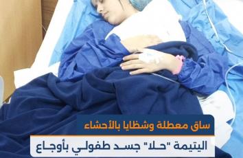ساق معطلة وشظايا بالأحشاء.. اليتيمة "حلا" جسد طفولي بأوجاع مُسن وأبواب طبية مغلقة