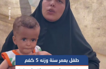 عمره 15 شهرًا ووزنه 5 كغم.. مرض مجهول يلتهم جسد الطفل ريان خضر بغزة وعائلته تطالب بإنقاذه
