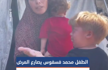 حالة الطفل محمد فسفوس تتدهور يومًا بعد آخر.. يعاني من تضخم في الكبد والكلى، وعائلته تناشد نقله للعلاج خارج قطاع غزة قبل فوات الأوان.