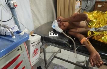 مصابون جراء استهداف طائرات الاحتلال خيمة تؤوي نازحين قرب جامعة الأقصى في مواصي خان يونس جنوبي قطاع غزة