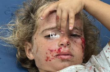 إصابة فلسطينيين بينهم أطفال في قصف إسرائيلي على مواصي خان يونس