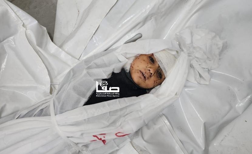 الصحة: 34 شهيدًا و68 إصابة خلال الـ24 ساعة الماضية في غزة