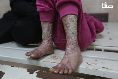 101224_Dair_EL-Balah_OSH_1_00(13)