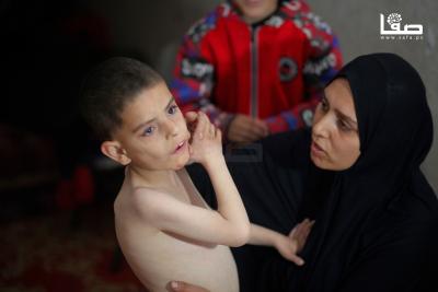 160425_Nusairat_MS_00(27)