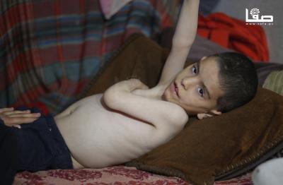 160425_Nusairat_MS_00(26)