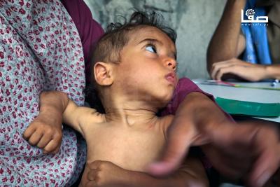 170725_Gaza_UNRWA_00(43)