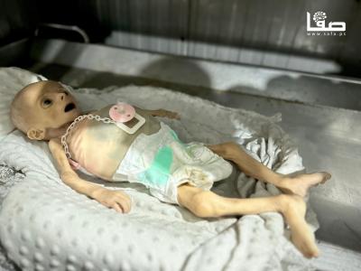 260725_Khan_Yunis_MT_00(32)