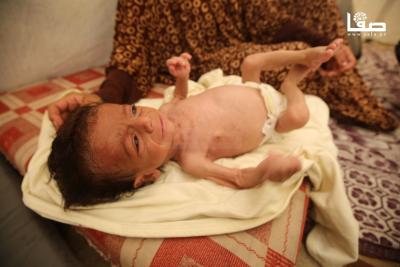 280725_Gaza_OSH_00(53)