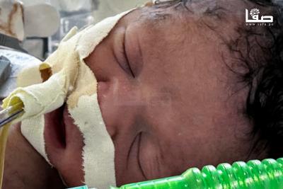 280725_Khan_Yunis_MT_00(8)