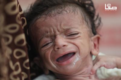 280725_Gaza_OSH_00(31)