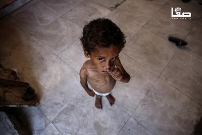 140725_GAZA_OSH_00(14)