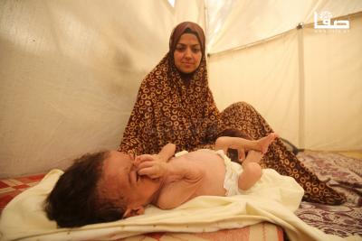 280725_Gaza_OSH_00(48)