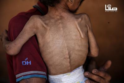 140725_GAZA_OSH_00(13)