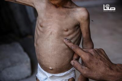 140725_GAZA_OSH_00(11)