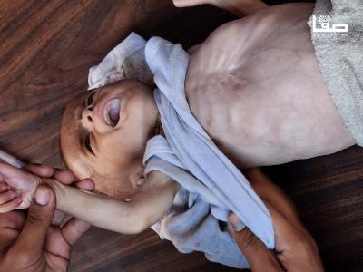 170725_Gaza_UNRWA_00(22)