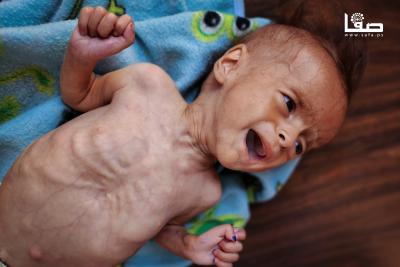 170725_Gaza_UNRWA_00(32)