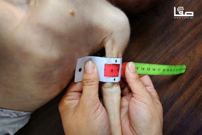 170725_Gaza_UNRWA_00(27)