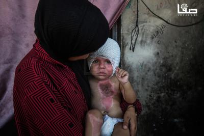 170825_Gaza_OSH_1_00(12)